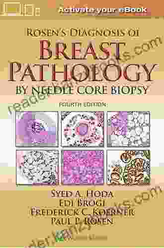 Rosen S Diagnosis Of Breast Pathology By Needle Core Biopsy